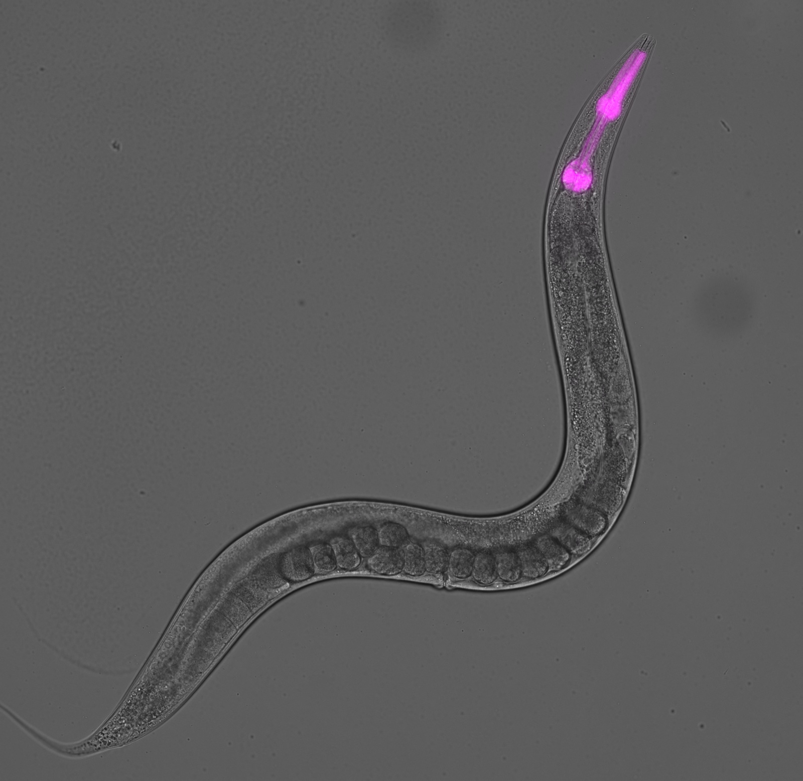A living C. elegans under the microscope, with a fluorescent marker glowing in its pharynx